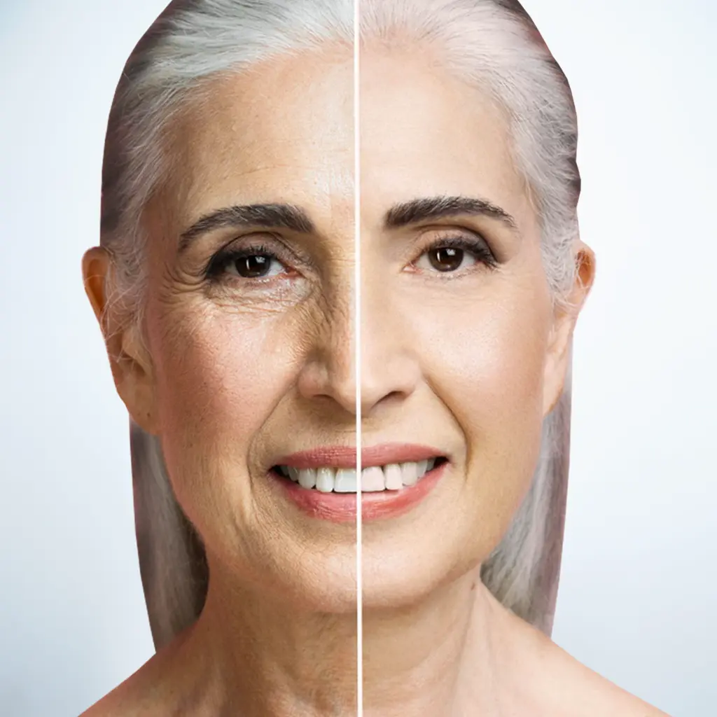 WRINKLE REDUCING INJECTIONS in pickering